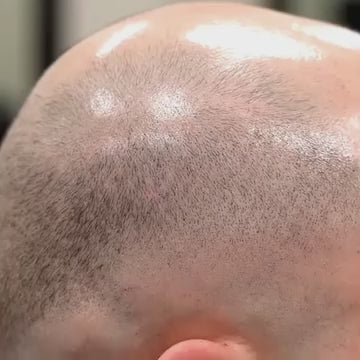 Follicure BioGrow Hair Restoration Spray 50 ml (Pack of 2)